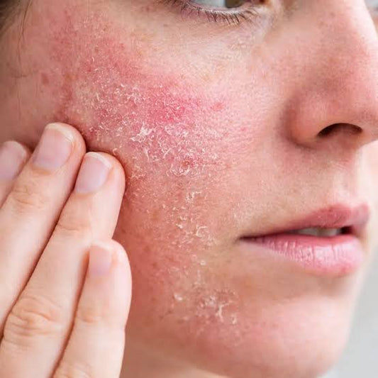 Discover why a healthy skin barrier is the key to balanced, resilient skin. Learn how personalised Dermaviduals skincare and professional treatments help support hydration, comfort, and long-term skin health.